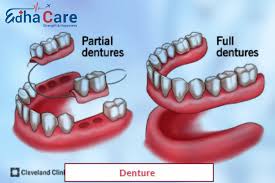 dentures treatment